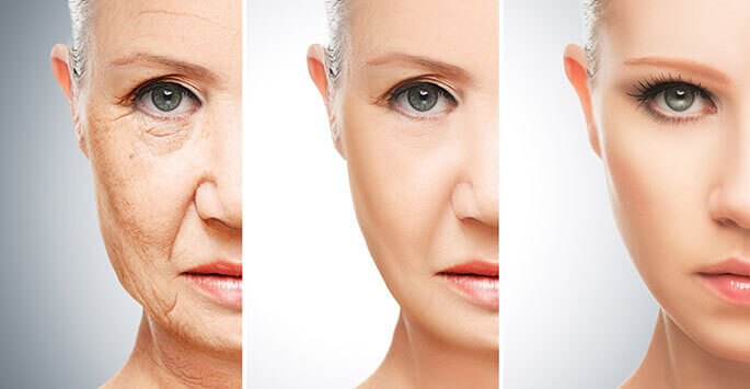 Anti-aging Solutions To Keep You Young, Beautiful and Attractive