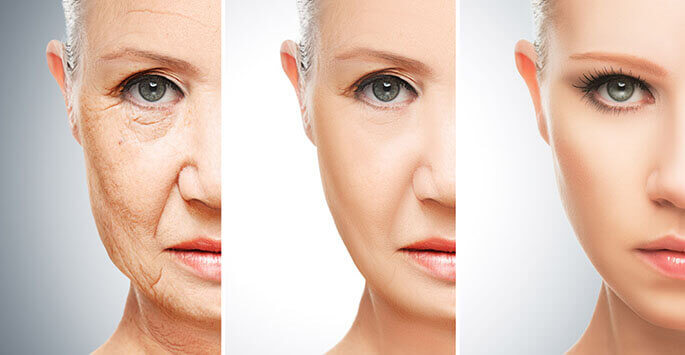 Anti-aging Solutions To Keep You Young, Beautiful and Attractive! | Blog