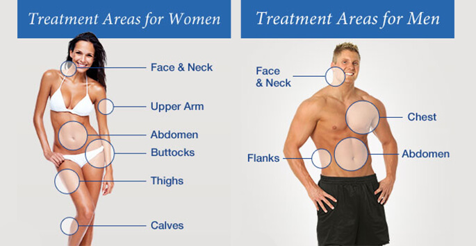 What Areas of the Body Can Liposuction Treat? - Cosmos Clinic