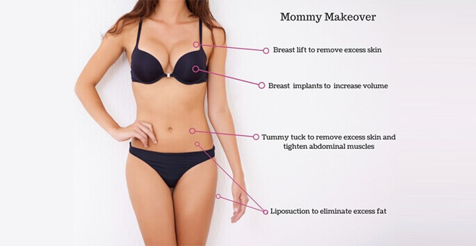 Top 5 Questions to Ask during Your Mommy Makeover Consultation