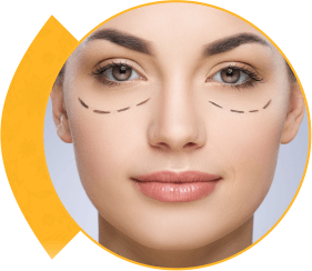 Blepharoplasty Surgery