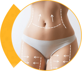 Body Contouring