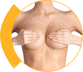 Breast Lift Surgery