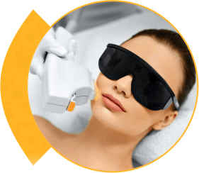 IPL Photofacial