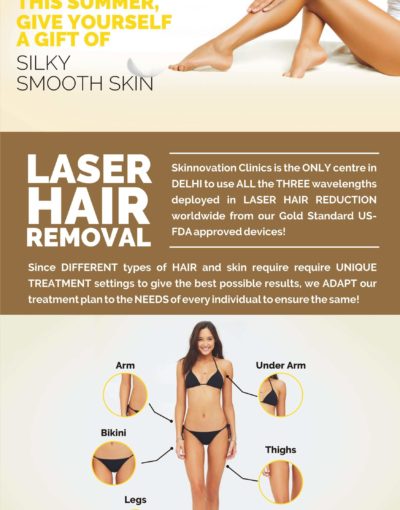 Laser Hair Removal