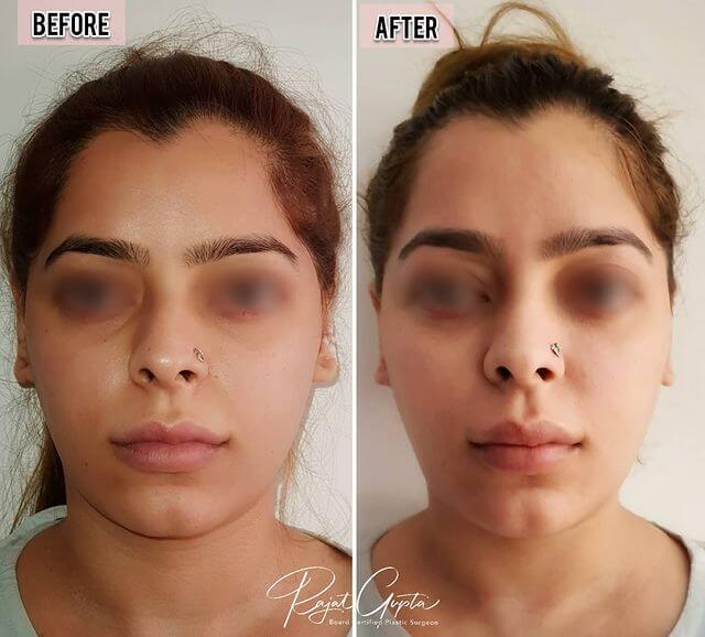 https://www.skinnovationclinics.com/wp-content/uploads/2019/04/Before-After-img8.jpg