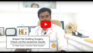 Fat Grafting in Delhi, Fat Transfer Surgery