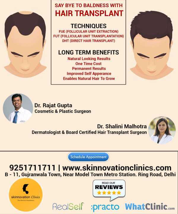 Hair Transplant Surgery by Best Hair Transplant Surgeon in Delhi