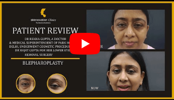 Patient Review - Blepharoplasty 02