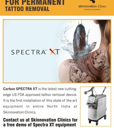 Tattoo Removal