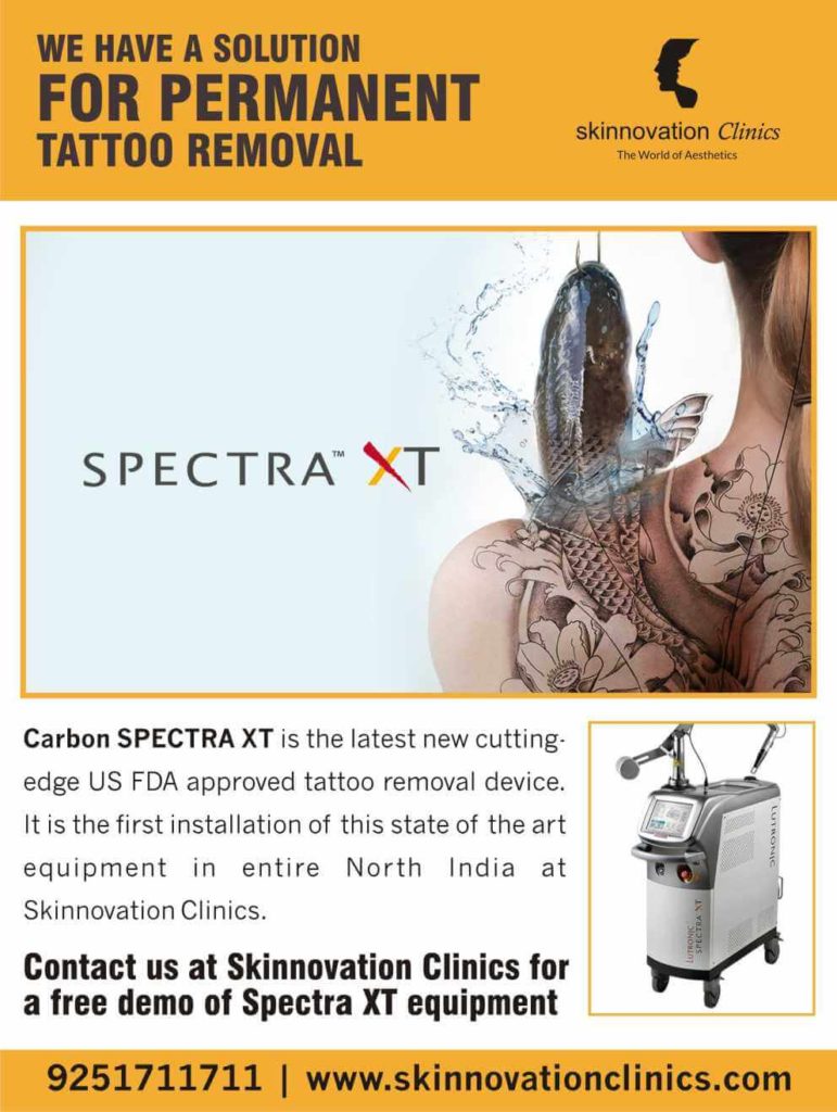 Laser Tattoo Removal Treatment in Delhi, Tattoos are effectively removed