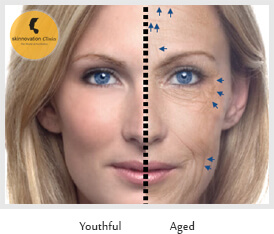 Anti ageing